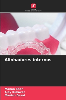 Paperback Alinhadores internos [Portuguese] Book