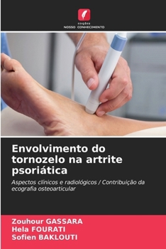 Paperback Envolvimento do tornozelo na artrite psoriática [Portuguese] Book
