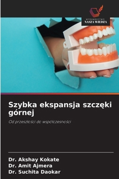 Szybka ekspansja szczeki górnej (Polish Edition)