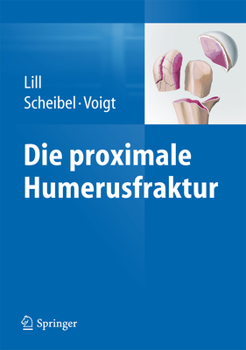 Hardcover Die Proximale Humerusfraktur [German] Book