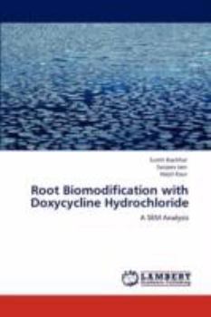 Paperback Root Biomodification with Doxycycline Hydrochloride Book