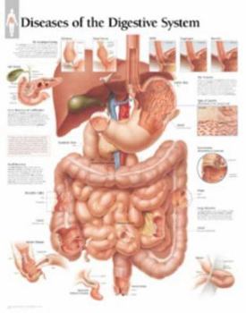 Unknown Binding Diseases of Digestive System Chart: Laminated Wall Chart Book