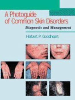 Hardcover Photo Guide of Common Skin Disorders: Diagnosis and Management Book