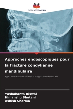 Paperback Approches endoscopiques pour la fracture condylienne mandibulaire [French] Book