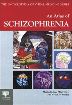 Hardcover Atlas of Schizophrenia Book