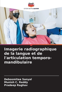 Imagerie radiographique de la langue et de l'articulation temporo-mandibulaire (French Edition)