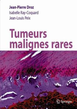 Hardcover Tumeurs malignes rares (French Edition) [French] Book