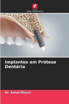 Paperback Implantes em Prótese Dentária [Portuguese] Book