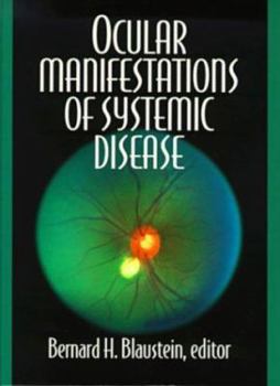 Hardcover Ocular Manifestation Book