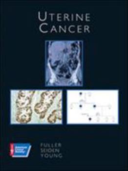 Hardcover Uterine Cancer [With CDROM] Book