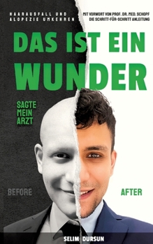 Das Ist Ein Wunder Sagte Mein Arzt: Haarverlust Und Alopezie Umkehren