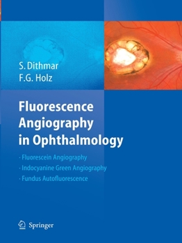 Paperback Fluorescence Angiography in Ophthalmology Book