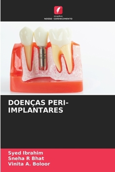 Paperback Doenças Peri-Implantares [Portuguese] Book