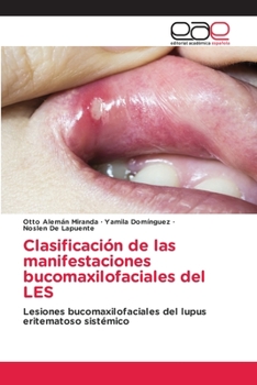 Paperback Clasificación de las manifestaciones bucomaxilofaciales del LES [Spanish] Book