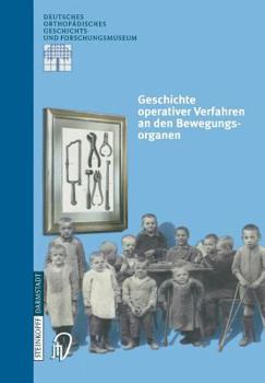 Paperback Geschichte Operativer Verfahren an Den Bewegungsorganen [German] Book