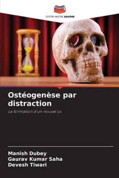 Ostéogenèse par distraction (French Edition)