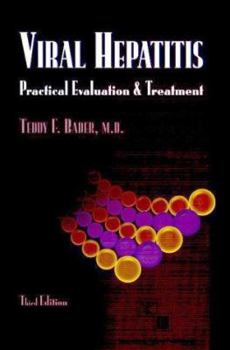 Hardcover Viral Hepatitis: Practical Evaluation and Treatment Book