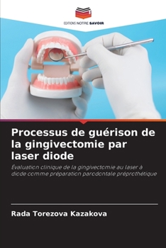 Paperback Processus de guérison de la gingivectomie par laser diode [French] Book