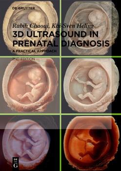 Hardcover 3D Ultrasound in Prenatal Diagnosis: A Practical Approach Book