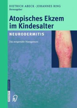 Paperback Atopisches Ekzem Im Kindesalter (Neurodermitis): Zeitgemäßes Management [German] Book