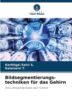 Paperback Bildsegmentierungs- techniken für das Gehirn [German] Book