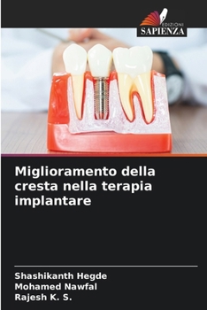 Paperback Miglioramento della cresta nella terapia implantare [Italian] Book