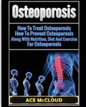 Paperback Osteoporosis: How To Treat Osteoporosis: How To Prevent Osteoporosis: Along With Nutrition, Diet And Exercise For Osteoporosis Book