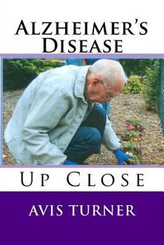 Paperback Alzheimer's Disease Up Close Book
