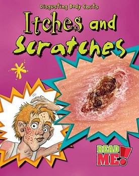 Itches and Scratches - Book  of the Disgusting Body Facts