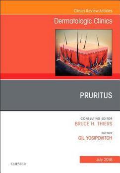 Hardcover Pruritus, an Issue of Dermatologic Clinics: Volume 36-3 Book