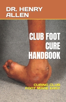 Paperback Club Foot Cure Handbook: Curing Club Foot Made Easy Book