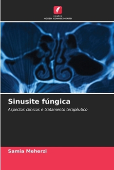 Paperback Sinusite fúngica [Portuguese] Book