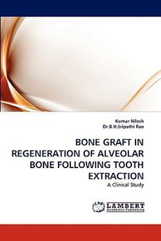 Paperback Bone Graft in Regeneration of Alveolar Bone Following Tooth Extraction Book