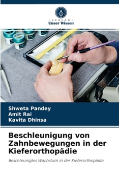 Paperback Beschleunigung von Zahnbewegungen in der Kieferorthopädie [German] Book