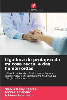 Paperback Ligadura do prolapso da mucosa rectal e das hemorróidas [Portuguese] Book