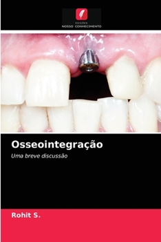 Paperback Osseointegração [Portuguese] Book