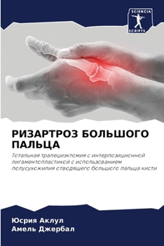 Paperback РИЗАРТРОЗ БОЛЬШОГО ПАЛЬ& [Russian] Book