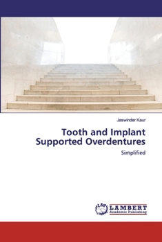 Paperback Tooth and Implant Supported Overdentures Book