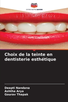 Paperback Choix de la teinte en dentisterie esthétique [French] Book