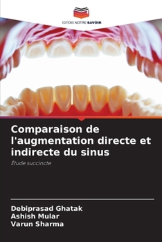 Paperback Comparaison de l'augmentation directe et indirecte du sinus [French] Book