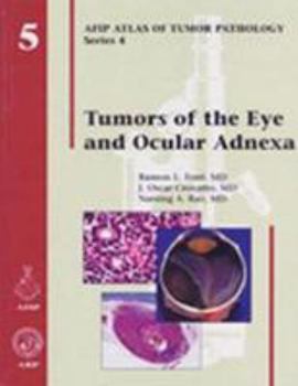 Hardcover Tumors of the Eye and Ocular Adnexa Book