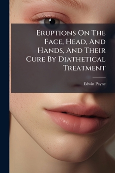 Paperback Eruptions On The Face, Head, And Hands, And Their Cure By Diathetical Treatment Book