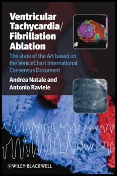Paperback Ventricular Tachycardia / Fibrillation Ablation: The State of the Art Based on the Venicechart International Consensus Document Book