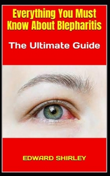 Paperback Everything You Must Know About Blepharitis: The Ultimate Guide Book