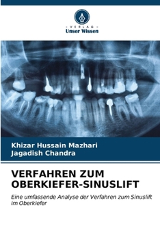 Paperback Verfahren Zum Oberkiefer-Sinuslift [German] Book