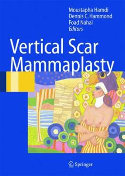 Paperback Vertical Scar Mammaplasty Book
