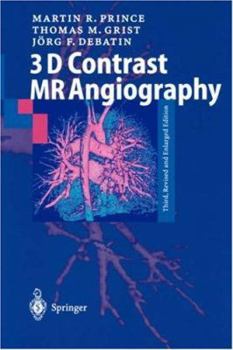 Paperback 3D Contrast MR Angiography Book
