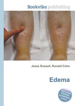 Paperback Edema Book