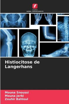 Paperback Histiocitose de Langerhans [Portuguese] Book