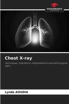 Paperback Chest X-ray Book